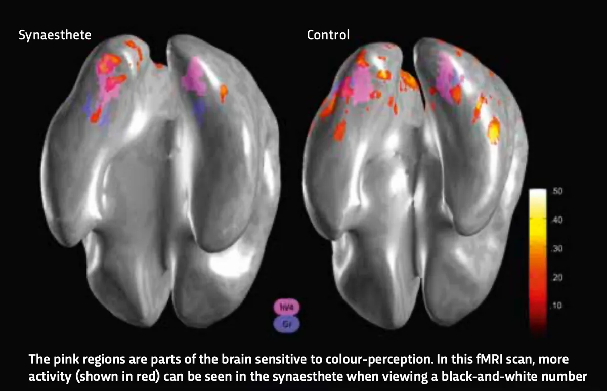 Beyond the Senses: Understanding Synaesthesia
